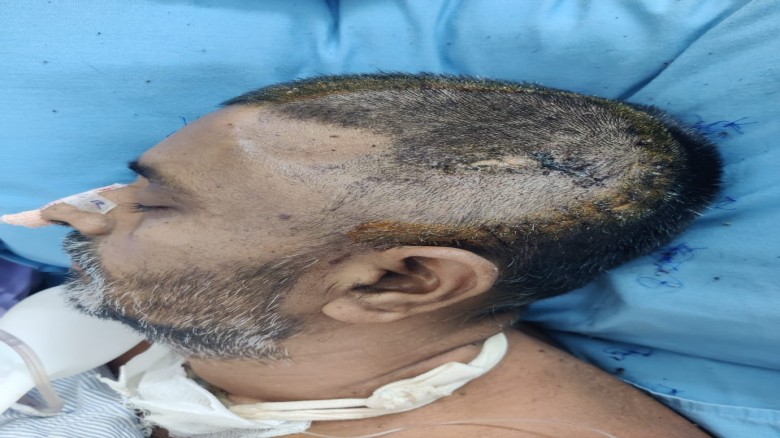 কালিয়াকৈরে সন্ত্রাসীদের হামলায় ২৬ দিন মৃত্যুর সঙ্গে পাঞ্জা